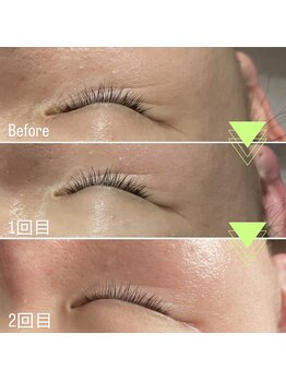 ルーシーガーデン(LUCY GARDEN)/ラミネーションピール