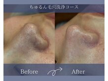 サロンドボーテアリス (Salon de beaute ALICE)/長年のザラつき角質もツルっと♪