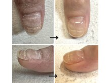 ローネイル(Raw nail)の雰囲気(日常生活に支障が出ないよう、削らずやさしく補強)