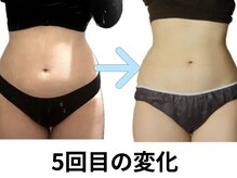 ヨサパーク リノ(YOSA PARK Lino)の雰囲気（身体の内側から脂肪撃退！リバウンドも阻止！お任せください☆）