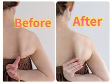 女性専用整体サロン フレル(Frele)/肩甲骨のシルエット改善◎肩こり
