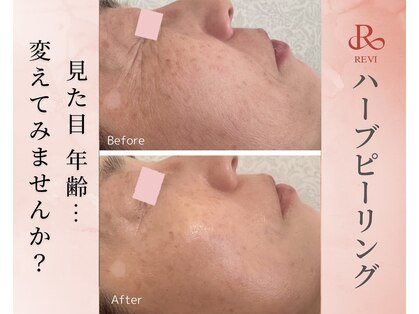 ククル(KUKULU)の写真