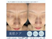 癒しのうるおい生泡毛穴洗浄ムートンホイップスパでくすみオフ◎