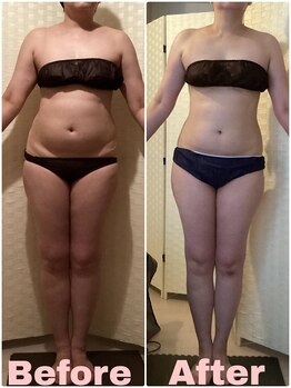 クリスタルビューティー/20回コース