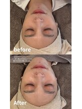 ニコ(nico)/トーンアッ！