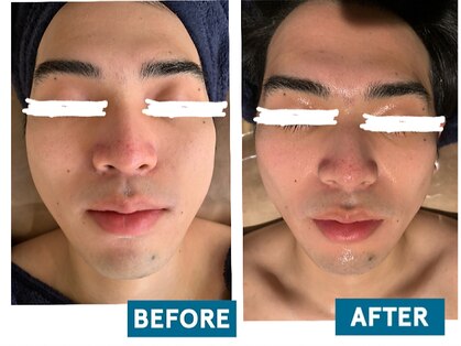 ビーアンドアイ シズオカテン メンズ(B＆I SHIZUOKA)の写真