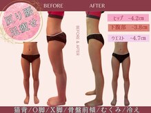 骨盤ちゃん 上越モール店の雰囲気（《痩せていても、歪みがあると台無し》美脚/O脚/X脚/）