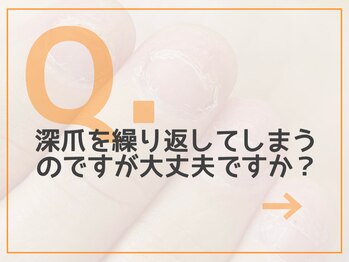 レアム/【Q.９】繰り返してしまう深爪。