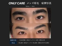 オンリィケア 関大前(ONLY CARE)/【U24 メンズ眉毛ワックス】