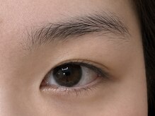 シェリー(Cherie)/before