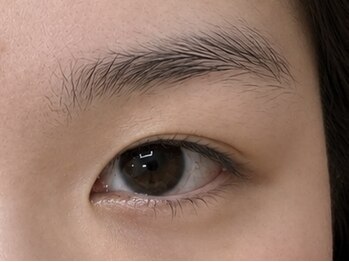 シェリー(Cherie)/before