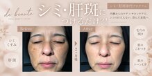 ドゥ ボーテ(de beaute)