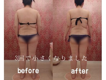 ソワンテラピー(Soin Therapy)/軟部ケア＆筋膜リリース