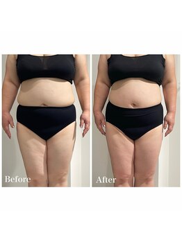 クリア(CLEAR)/整う本気のダイエット