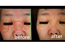 ファイブエレガンテ(5Elegante)/ビフォーアフター