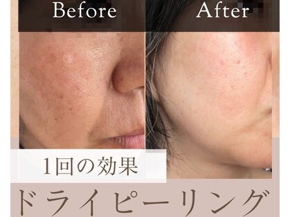 リエート(Lieto)の写真