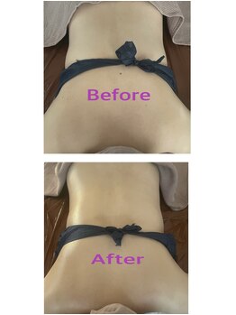 ラネージュ(LA NEIGE)/【LANEIGE】バザルト背中