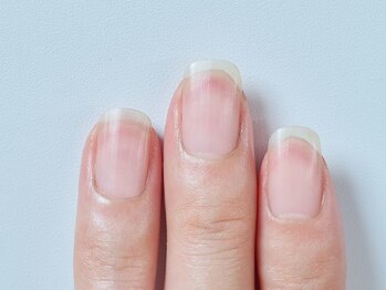 育爪 自由が丘店/育爪カルテ01