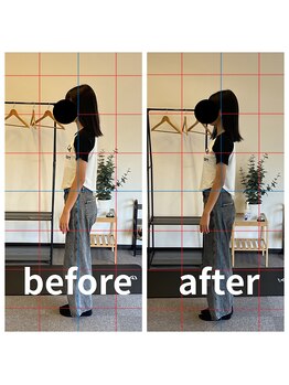 熊本カワル整体 JR上熊本駅院/姿勢矯正