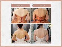 ソウイボディ 武蔵小杉店(Sou-i body)/ブライダルbefore→ after