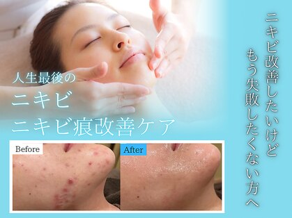 エピア 岡崎店(Epia)の写真
