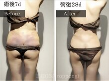 インディバ 六本木の雰囲気（【医療提携】"脂吸"DTケア特化/インディバ最新機種ER200取扱）