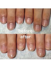 リコロン 銀座(Re:)/【最強のネイルケアメソッド】