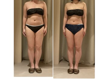 ドゥ ボーテ(de beaute)/何しても痩せなかったのに!