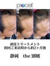 ザ ベッピン(the 別嬪)/頭皮は提携美容院にて施術可能