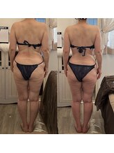 サロン ド ミニョン(salon de mignon)/これが最後のダイエット！！