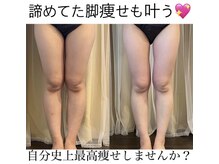 ヨサパーク 綾瀬店(YOSAPARK)の雰囲気（ルルオンなら痩せなかった原因にアプローチ☆自分史上最高痩せ！）