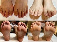 ビサンテ サロン/爪の悩み＆角質ケアのNail Salon