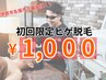 5名限定！新規ヒゲ脱毛　￥7,900→￥1,000