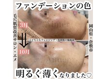 エメ(Aimer)/リアボーテタラソトリートメント