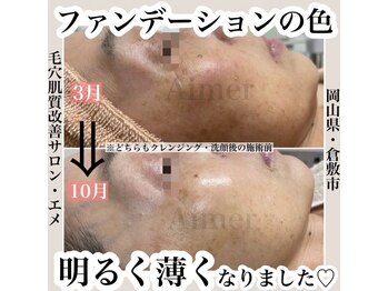 エメ(Aimer)/リアボーテタラソトリートメント