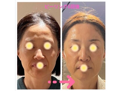 アマランス(Amarans)の写真