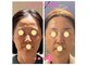 アマランス(Amarans)の写真