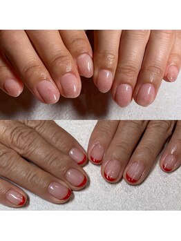 テテ アイル(Tete aile)/ジェルBコース