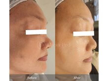 エングロー 錦糸町店(Englow)/