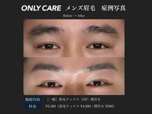 オンリィケア 関大前(ONLY CARE)/【眉毛ワックスメンズ】