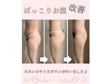ジョアン(Johan)の雰囲気（一流マシンでエステ以上の結果をご体験下さい♪リンパ・痩身☆）