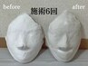 小顔コルギ　サブスクプラン《初回》2週間に1回コース