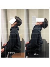 ナオル整体 浅草院(NAORU整体)/20代男性　肩首こり【後屈】