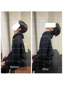 ナオル整体 浅草院(NAORU整体)/20代男性 肩首こり【後屈】