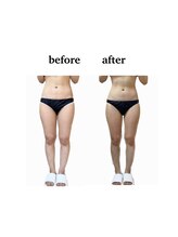 ステラ(stella)/全身痩せ