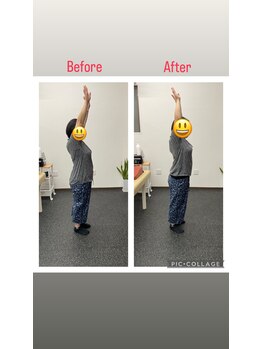 ブロッサム(Blossom)/姿勢改善