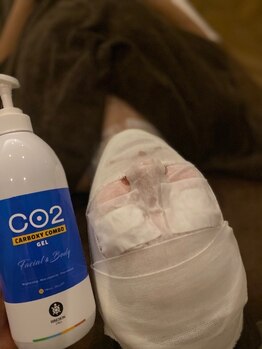 ビューティーサロン シャーロット(Beauty Salon Charlotte)/カーボキシーパック