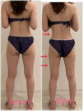 スペチアーレ 夙川/夏に向けて美ボディ＆美顔に