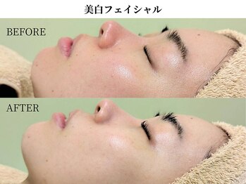 サンビ(SANBI)/パックは贅沢に3種類も使用！