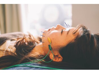 ハウ(How)/image ［岡山 整体 美容鍼］